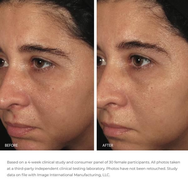 Image Skincare Ormedic Balancing Bio-Peptide Creme - JoyVIVA -  
