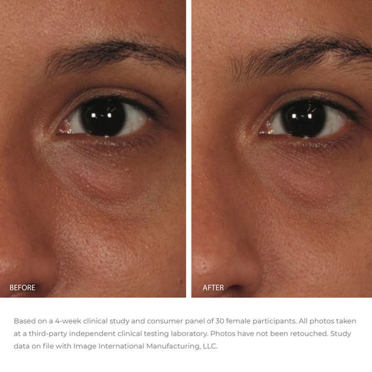 Image Skincare Ormedic Balancing Eye Lift Gel - JoyVIVA -  