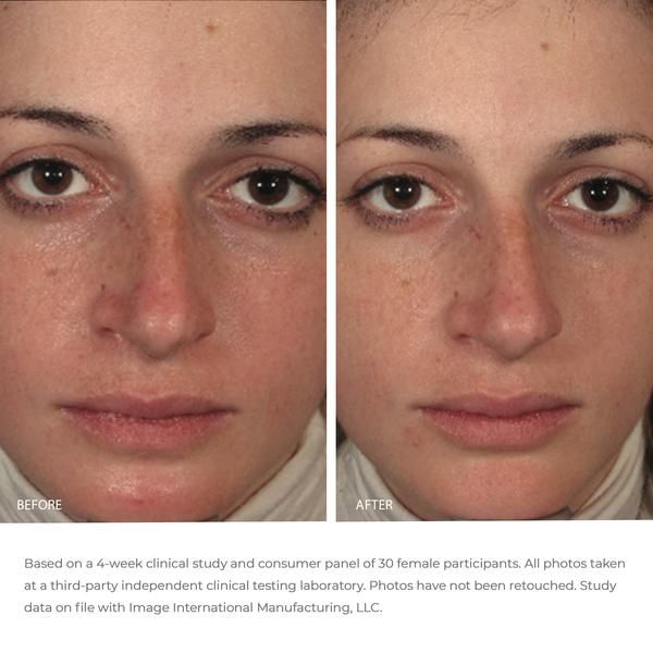Image Skincare Ormedic Balancing Gel Masque - JoyVIVA -  