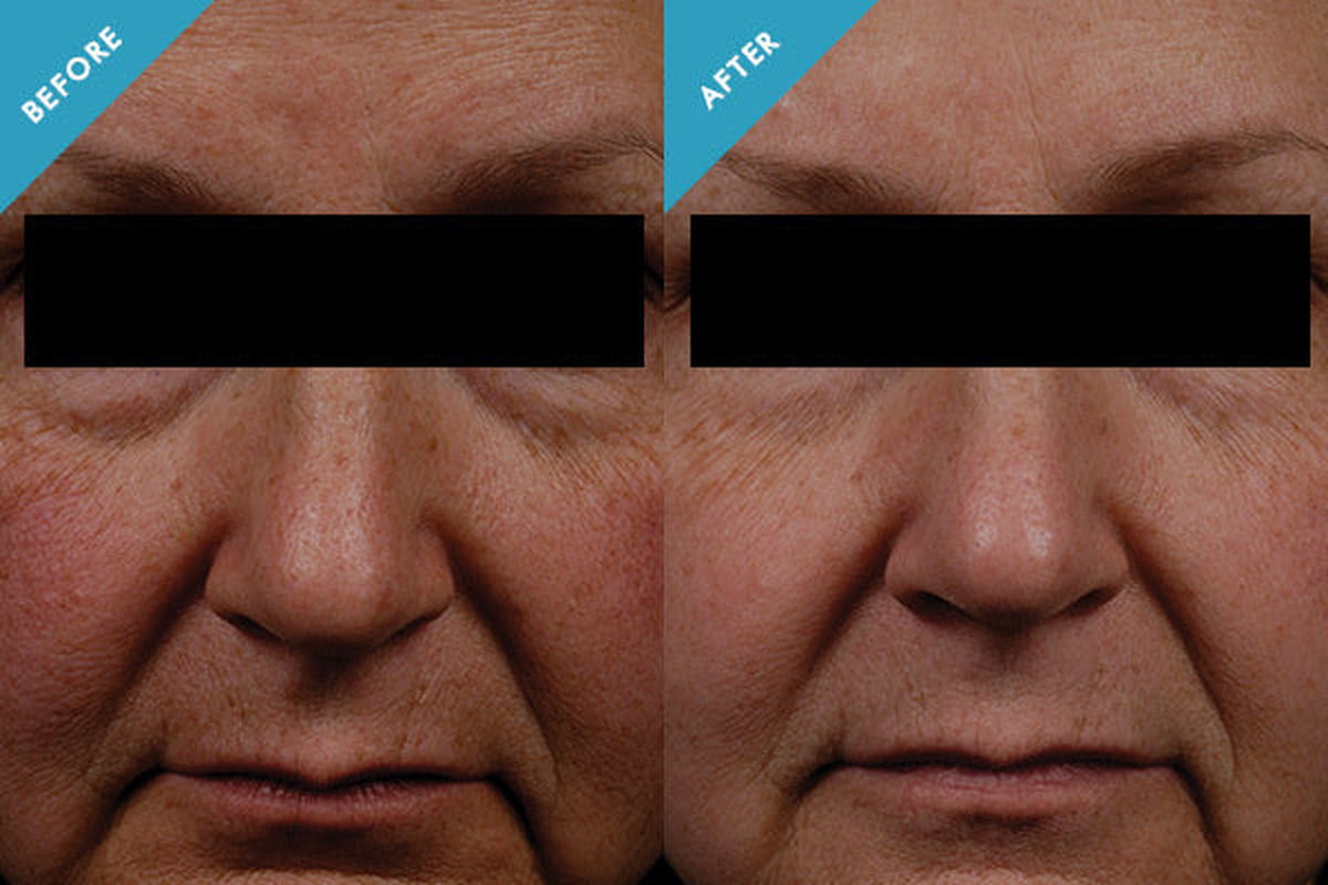 SkinCeuticals Phloretin CF - JoyVIVA -  