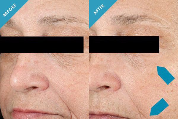 SkinCeuticals Triple Lipid Restore - JoyVIVA -  