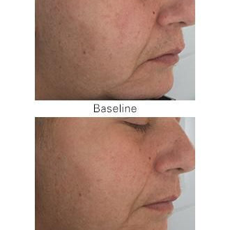 ZO Skin Health Firming Serum - JoyVIVA -  