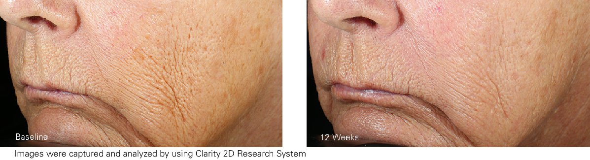 ZO Skin Health Wrinkle + Texture Repair